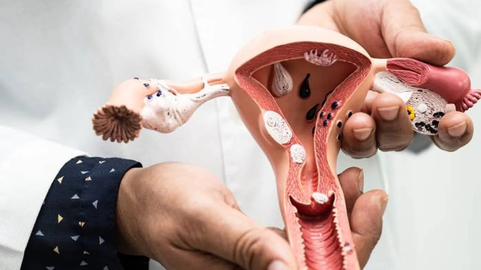 Consulta para manejo de infecciones vaginales